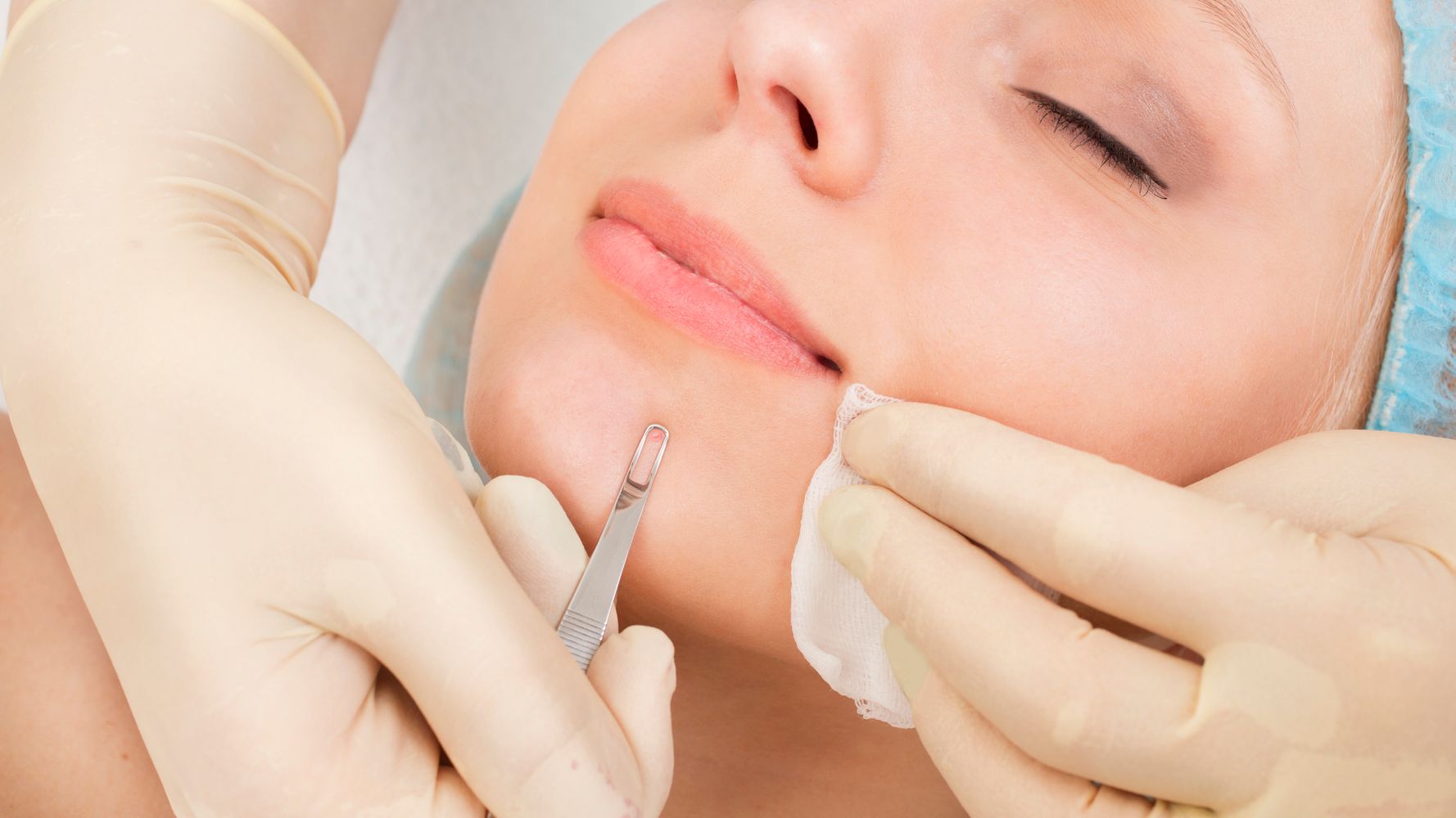 facial with extractions in Lakewood, CO